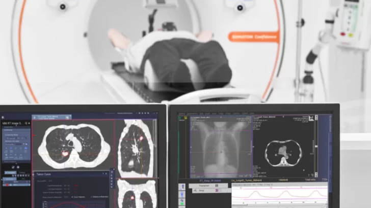 El Hospital Marcial Quiroga lanzó un programa gratuito de detección temprana de cáncer de pulmón El Hospital Marcial Quiroga lanzó un programa gratuito de detección temprana de cáncer de pulmón