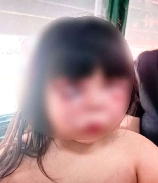 Horror: un hombre le desfiguró la cara a golpes a una nena de 7 años, atacó a la madre y fue detenido por vecinos Horror: un hombre le desfiguró la cara a golpes a una nena de 7 años, atacó a la madre y fue detenido por vecinos
