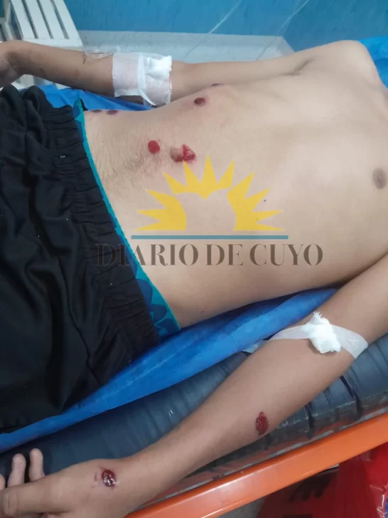 menor-baleado-en-marquesado20261-546x728