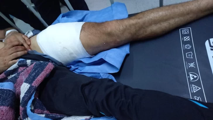 pierna-de-riveros-16-01-26-728x410