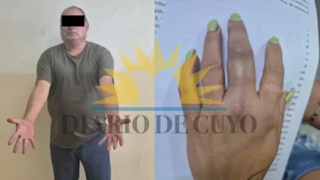 Condenaron al hombre que le quebró los dedos de la mano a su hija durante una discusión en Rawson Condenaron al hombre que le quebró los dedos de la mano a su hija durante una discusión en Rawson